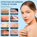 mitgary-advanced-scar-gel-silicone-scar--4.jpg