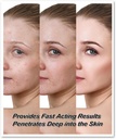 dermatitis-inflammation-and-rashes-body--4.jpg
