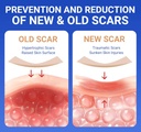 silicone-scar-sheets-surgical-tape-16x12-4.jpg