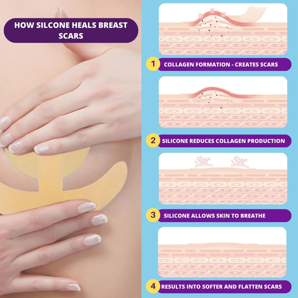breast-reduction-recovery-supplies-after-2.jpg