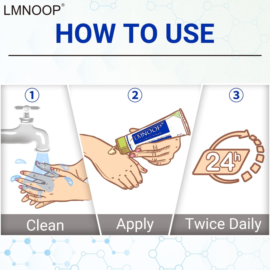 eczema-cream-maximum-strength-treatment--6.jpg