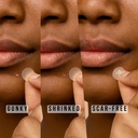centella-hydrocolloid-patch-bosscare-ori-6.jpg