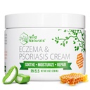 Wild Naturals Eczema & Psoriasis Crema per pelli secche, prurito – Eczema Rilievo per adulti e bambini – Crema idratante di psoriasi con miele di Manuka - Idratazione di miele Lozione per mani e viso