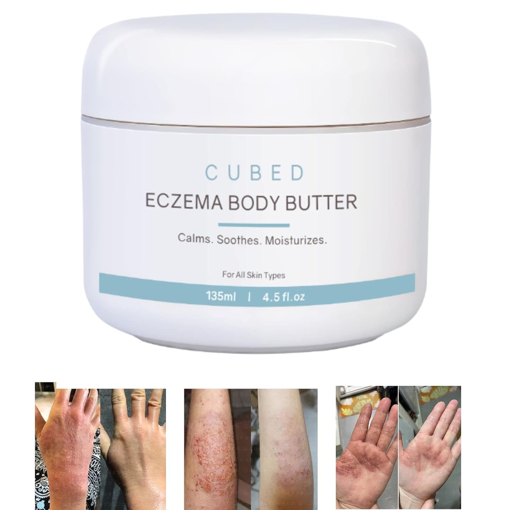 Cubed 4.5 oz Eczema Crema per Adulti, Eczema Rilievo, Trattamento Eczema, idratare la pelle irritata a secco, Lozione intelligente per Topical steroidi Ritiro sintomi, Psoriasi & Rosacea, Eczema, Dermatite