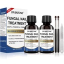 Toenail Fungus Trattamento Extra Forza con 25% Acido Undecylenic, Trattamento toenail Ingrown, Ricostruzione Unghie, Trattamento unghie Fungus, Toenail giallo, Danneggiamento unghie fungo trattamento extra forza