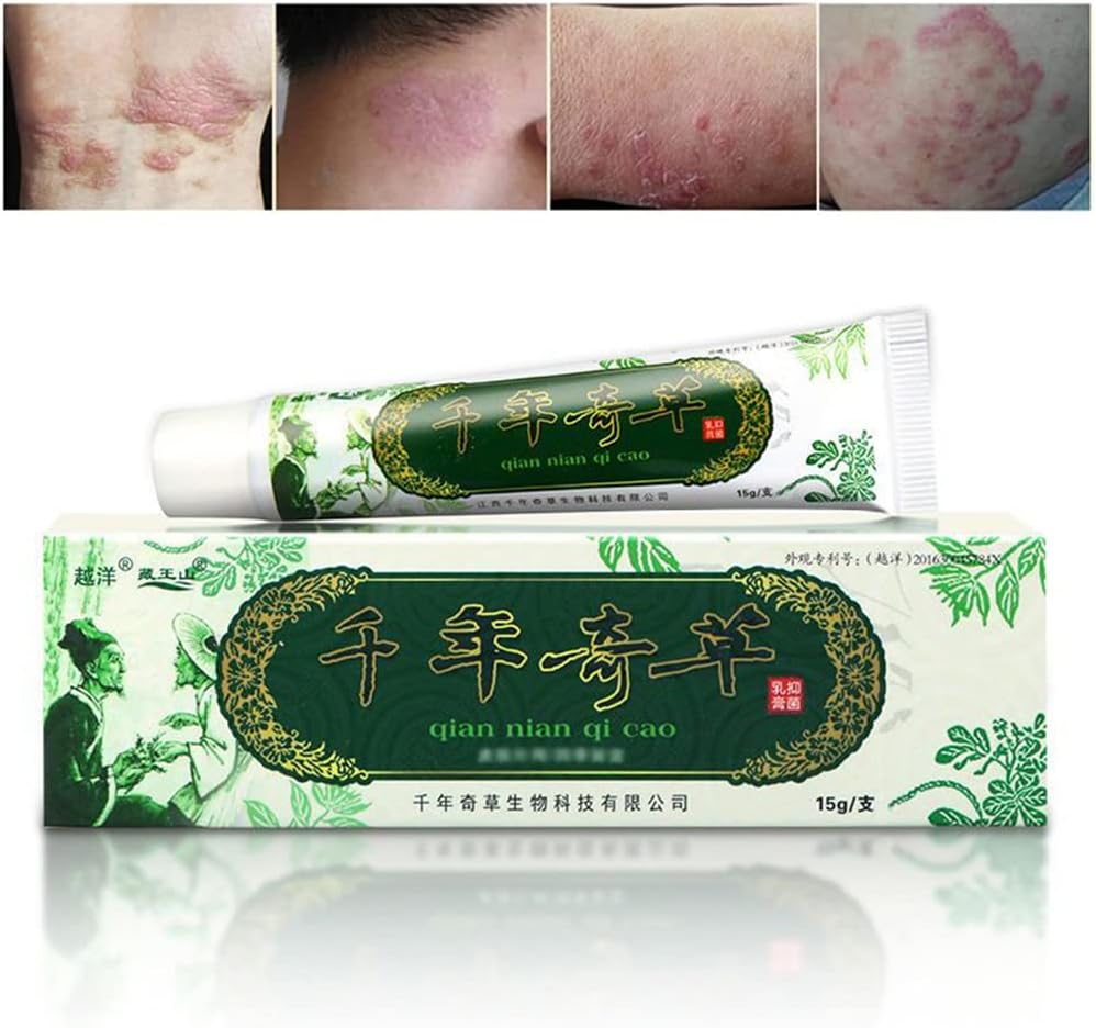 Eczema erboso cinese, Psoriasi Creme Dermatite ed Eczema Pruritus Psoriasis JIULIN Ointment