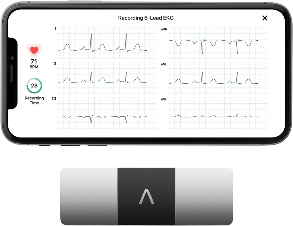 AliveCor KardiaMobile 6-Lead Personal EKG Monitor – Six Views of The Heart – Rileva AFib e Aritmie Irregolari – Risultati istantanei in 30 secondi – Funziona con la maggior parte degli smartphone