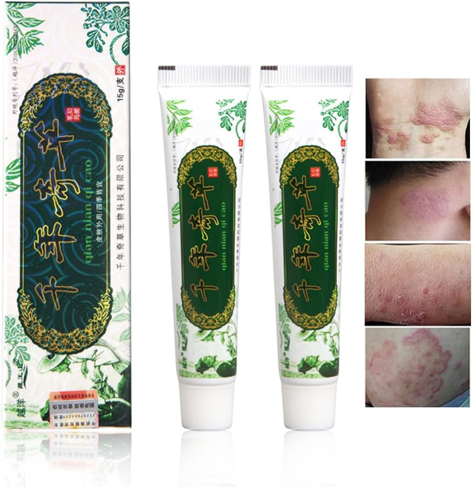 Eczema erboso cinese, Psoriasis Cream Dermatite ed Eczema Pruritus Psoriasis JIULIN Ointment (2PCS)