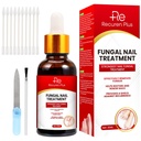 Toe Nail Fungus Trattamenti per Toenail: Trattamento Fungo Unghie per Fingernails – Extra Forza, Soluzione ad azione rapida per Unghie Cracked, Danneggiate, Scolorite