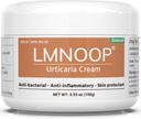 Urticaria Cream, Hives Relief Formula avanzata per prurito, rossore, brufoli, rash, Edema e altri sintomi della pelle