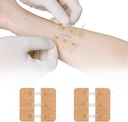 Zip Stitch Laceration Riparazione Senza Stitches Butterfly Bandaids Chiusura rapida - Dispositivo di chiusura guanto di emergenza 2 pezzi(PU)