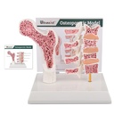Modello di osteoporosi dell'anatomia umana ultrassista, modello di scheletro anatomico di Vertebrae con carta di studio per la dimostrazione di insegnamento degli studenti medici
