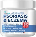 Bio-MD Psoriasis Eczema Crema, Crema Eczema per Adulti, Rioccurrenza di controllo di resistenza extra, Alleviare il sintomo di resistente, Efficace per la dermatite seborreica, Trattamento di Folliculitis