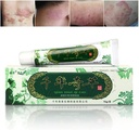 Eczema erboso cinese, Psoriasi Creme Dermatite ed Eczema Pruritus Psoriasis JIULIN Ointment