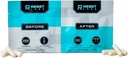 Pre & post Bere Recovery Capsule - Formula naturale - Supporto per fegato con cardo al latte - Sugar Free - Ginger - Electrolytes - Prickly Pear - Qualcosa per una settimana di disintossicazione (1 pacchetto)