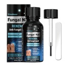 Trattamento del fungo dell'unghia, Trattamento del fungo dell'unghia per l'unghia, Soluzione di riparazione dell'unghia, Liquido di rinnovi delle unghie per unghie danneggiate e discolorazione, Trattamento del fungo dell'unghia, Sicuro e Gently - 30ML (1 FLOZ)