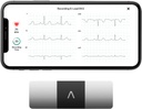 AliveCor KardiaMobile 6-Lead Personal EKG Monitor – Six Views of The Heart – Rileva AFib e Aritmie Irregolari – Risultati istantanei in 30 secondi – Funziona con la maggior parte degli smartphone