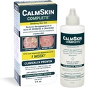 Xenna CalmSkin Complete | Clinically Proven to Soothe Irritated Skin and Better The Appearance of Skin with Mild to Moderate Psoriasis | Made in the USA | 4 fl. oz.