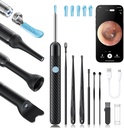 Loyker X6 Ear Wax Removal Tool Camera, Ear Cleaner con fotocamera, FSA - HSA Store eleggibile, 1080P Ear Camera con luce 6LED per orecchio / rumore / tiro / pietra esame, nero