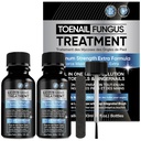 Toenail Fungus Trattamento Extra Forza 2pcs x 30ml, Fungus Trattamento Unghie, Nail Fungus Trattamento per Toenail, Toe Nail Fungus Trattamento Extra Forza per Unghie Damaged e Scolorazione.